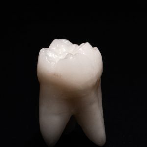 IMG_2872