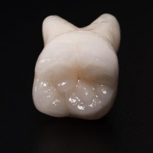 keramicke-zuby-4